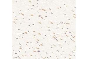 Immunohistochemistry (Paraffin-embedded Sections) (IHC (p)) image for anti-Suppressor of Ty 3 Homolog (SUPT3H) antibody (ABIN7075767)