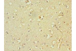 Immunohistochemistry of paraffin-embedded human brain tissue using ABIN7161335 at dilution of 1:100 (TACR3 抗体  (AA 356-465))