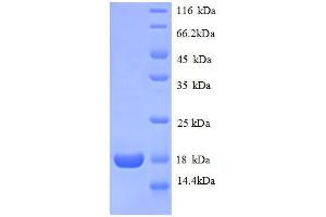 SDS-PAGE (SDS) image for Ribosomal Protein L31 (RPL31) (AA 1-125), (full length) protein (His tag) (ABIN1046447)