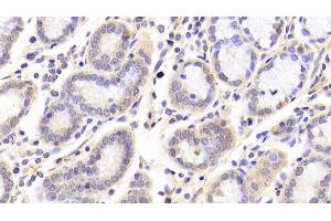 Detection of SIRT3 in Human Stomach Tissue using Polyclonal Antibody to Sirtuin 3 (SIRT3) (SIRT3 抗体  (AA 126-399))