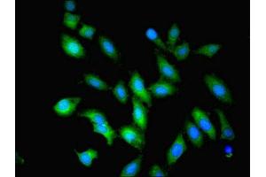 Immunofluorescent analysis of Hela cells using ABIN7162111 at dilution of 1:100 and Alexa Fluor 488-congugated AffiniPure Goat Anti-Rabbit IgG(H+L) (OLA1 抗体  (AA 1-396))
