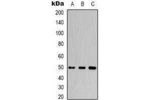 Western blot analysis of Beta3-tubulin expression in Hela (A), mouse brain (B), rat brain (C) whole cell lysates. (TUBB3 抗体)