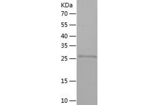 MORF4L2 Protein (AA 1-288) (His tag)