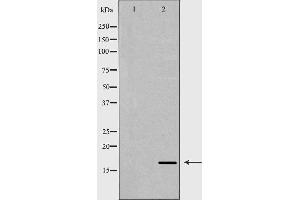 Western blot analysis of extracts of mouse liver, using ANG antibody. (ANG 抗体  (Internal Region))