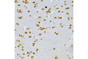 Immunohistochemistry of paraffin-embedded mouse brain using DKC1 Antibody (ABIN5970956) at dilution of 1/200 (40x lens). (DKC1 抗体)