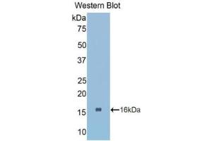 Western blot analysis of the recombinant protein. (CTGF 抗体  (AA 80-200))