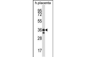 Western blot analysis in human placenta tissue lysates (35ug/lane). (STK26/MST4 抗体  (AA 271-299))