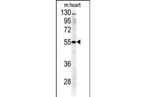 Western blot analysis in mouse heart tissue lysates (35ug/lane). (B4GALT5 抗体  (C-Term))