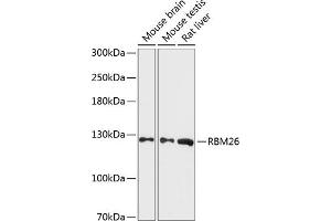Western blot analysis of extracts of various cell lines, using RBM26 antibody (ABIN6130214, ABIN6146770, ABIN6146772 and ABIN6216994) at 1:3000 dilution. (RBM26 抗体  (AA 65-140))
