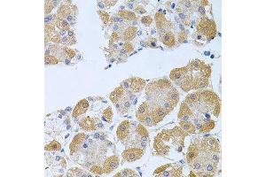Immunohistochemistry of paraffin-embedded human stomach using PROK2 antibody. (PROK2 抗体  (AA 20-129))