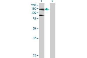 Western Blot analysis of HIP1R expression in transfected 293T cell line by HIP1R MaxPab polyclonal antibody. (HIP1R 抗体  (AA 1-1068))