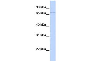 WB Suggested Anti-RNF6 Antibody Titration:  0. (RNF6 抗体  (C-Term))
