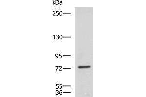 Western blot analysis of NIH/3T3 cell lysate using KIF2A Polyclonal Antibody at dilution of 1:850 (KIF2A 抗体)