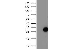 HEK293T cells were transfected with the pCMV6-ENTRY control (Left lane) or pCMV6-ENTRY ARL11 (Right lane) cDNA for 48 hrs and lysed. (ARL11 抗体)