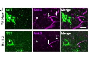 Representative micrographs showing immunohistochemical labelling for SSt (green), the AIS marker AnkyrinG (AnkG, magenta, cat.