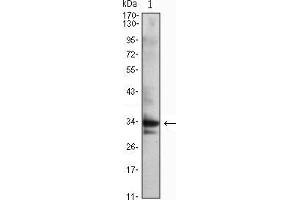Western blot analysis using CDC2 mouse mAb against Jurkat (1) cell lysate. (CDK1 抗体)