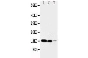 Anti-IL2 antibody, Western blotting Lane 1: Recombinant Mouse IL2 Protein 10ng Lane 2: Recombinant Mouse IL2 Protein 5ng Lane 3: Recombinant Mouse IL2 Protein 2. (IL-2 抗体  (C-Term))