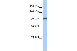 WB Suggested Anti-CCDC52 Antibody Titration: 0. (SPICE1 抗体  (N-Term))