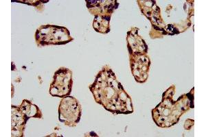 IHC image of ABIN7169072 diluted at 1:500 and staining in paraffin-embedded human placenta tissue performed on a Leica BondTM system. (CDC42BPB 抗体  (AA 1609-1711))