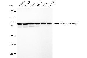 Western blotting analysis using Galactosidase beta 1 antibody (ABIN7798684). (Recombinant GLB1 抗体)