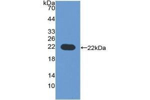 Detection of Recombinant CYP3A4, Human using Polyclonal Antibody to Cytochrome P450 3A4 (CYP3A4) (CYP3A4 抗体  (AA 344-497))
