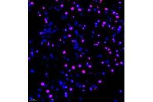 Immunofluorescence of paraffin embedded mouse pancreas using FUS (ABIN7075919) at dilution of 1:1000 (400x lens) (TLS/FUS 抗体)