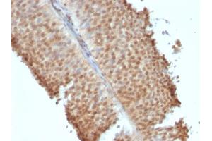 Immunohistochemistry (IHC) image for anti-Estrogen Receptor 2 (ESR2) (C-Term) antibody (ABIN6939350)