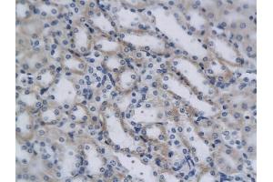 Formalin-fixed and paraffin embedded mouse kidney cells labeled with Rabbit Anti-CD4 Polyclonal Antibody, Unconjugated (ABIN672936) 1:200 followed by conjugation to the secondary antibody and DAB staining.