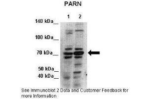 Lanes:   Lane 1: 7ug HEK293 cytoplasmic lysate  2: 7ug HEK293 nuclei lysate  Primary Antibody Dilution:   1:500  Secondary Antibody:   Anti-rabbit-HRP  Secondary Antibody Dilution:   1:500  Gene Name:   PARN  Submitted by:   Seiji Masuda, Kitashirakawa Oiwakecho, Kyoto University (PARN 抗体  (N-Term))