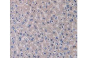 IHC-P analysis of Mouse Tissue, with DAB staining. (IRS1 抗体  (AA 837-1089))