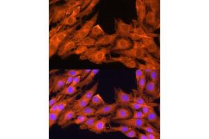 Immunofluorescence analysis of C6 cells using PRKCB antibody (ABIN6128463, ABIN6146200, ABIN6146202 and ABIN6221544) at dilution of 1:100. (PKC beta 抗体  (AA 220-340))