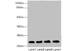 Western blot All lanes: CRIP2 antibody at 5. (CRIP2 抗体  (AA 1-208))