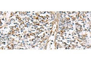 Immunohistochemistry of paraffin-embedded Human tonsil tissue using NPC2 Polyclonal Antibody at dilution of 1:80(x200) (NPC2 抗体)