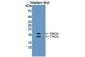 Detection of Recombinant FABP4, Rat using Polyclonal Antibody to Fatty Acid Binding Protein 4 (FABP4) (FABP4 抗体  (AA 2-132))