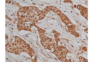 Immunohistochemistry (IHC) image for anti-Bone Morphogenetic Protein 3 (BMP3) (Internal Region) antibody (ABIN6260282)
