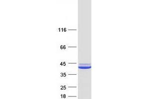 Western Blotting (WB) image for Small Glutamine-Rich Tetratricopeptide Repeat (TPR)-Containing, alpha (SGTA) protein (Myc-DYKDDDDK Tag) (ABIN2731940)