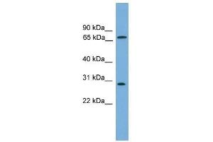 Western Blot showing SEMG2 antibody used at a concentration of 1-2 ug/ml to detect its target protein. (SEMG2 抗体  (N-Term))