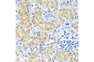 Immunohistochemistry of paraffin-embedded mouse kidney using SCO1 antibody. (SCO1 抗体  (AA 1-160))