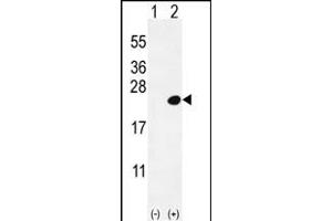 Western blot analysis of DOK5 (arrow) using rabbit polyclonal DOK5 Antibody  (ABIN392075 and ABIN2841837). (DOK5 抗体  (C-Term))