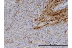 Immunostaining (ISt) image for anti-Collagen, Type I, alpha 1 (COL1A1) (AA 1021-1108) antibody (ABIN514511)
