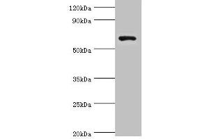 Western blot All lanes: Glutamate decarboxylase 1 antibody at 8 μg/mL + HepG2 whole cell lysate Secondary Goat polyclonal to rabbit IgG at 1/10000 dilution Predicted band size: 67, 26, 48 kDa Observed band size: 67 kDa (GAD 抗体  (AA 1-200))