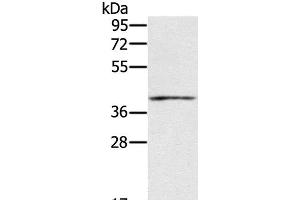 Western Blot analysis of Mouse muscle tissue using IFNGR2 Polyclonal Antibody at dilution of 1:200 (IFNGR2 抗体)