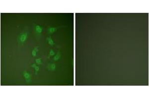 Immunofluorescence analysis of HepG2 cells, using Smad2 (Ab-467) Antibody. (SMAD2 抗体  (AA 418-467))