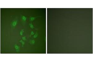 Immunofluorescence analysis of HepG2 cells, using Smad2 (Ab-467) Antibody.