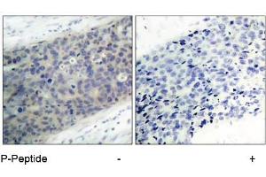 Image no. 3 for anti-LIM Domain Kinase 2 (LIMK2) (pThr505) antibody (ABIN196832) (LIMK2 抗体  (pThr505))