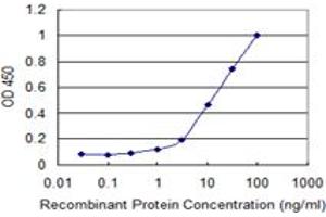 Detection limit for recombinant GST tagged ULK2 is 0. (ULK2 抗体  (AA 743-843))
