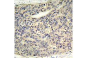 Immunohistochemistry (IHC) image for anti-LIM Domain Kinase 1 (LIMK1) (pThr508) antibody (ABIN1681739) (LIM Domain Kinase 1 抗体  (pThr508))