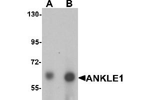 Western blot analysis of ANKLE1 in 293 cell lysate with ANKLE1 antibody at (A) 1 and (B) 2 µg/mL. (ANKLE1 抗体  (C-Term))