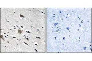 Immunohistochemistry analysis of paraffin-embedded human brain tissue, using MRPL52 Antibody. (MRPL52 抗体  (AA 71-120))