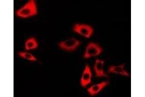 Immunofluorescent analysis of Calsarcin 1 staining in U2OS cells. (MYOZ2 抗体)